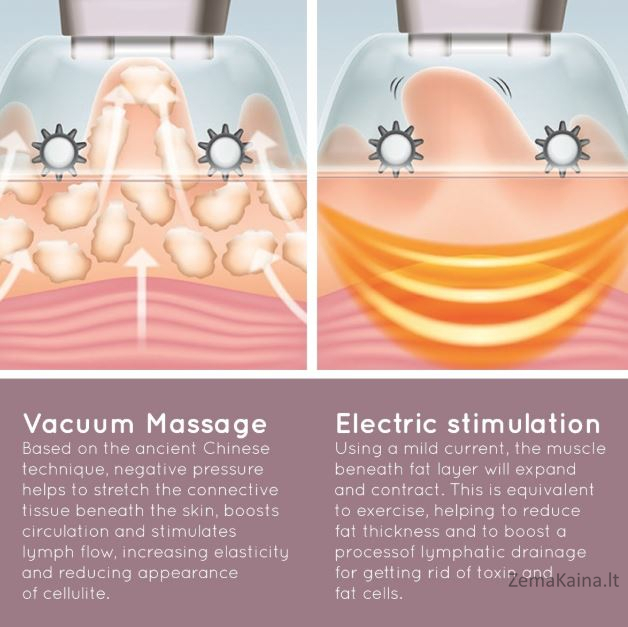 Homedics CELL-500-EU Smoothee 2