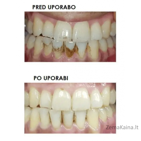 Silkn ToothWave TW1PE3001 3
